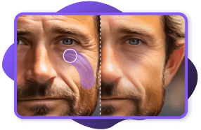 Picture Wrinkle Remover